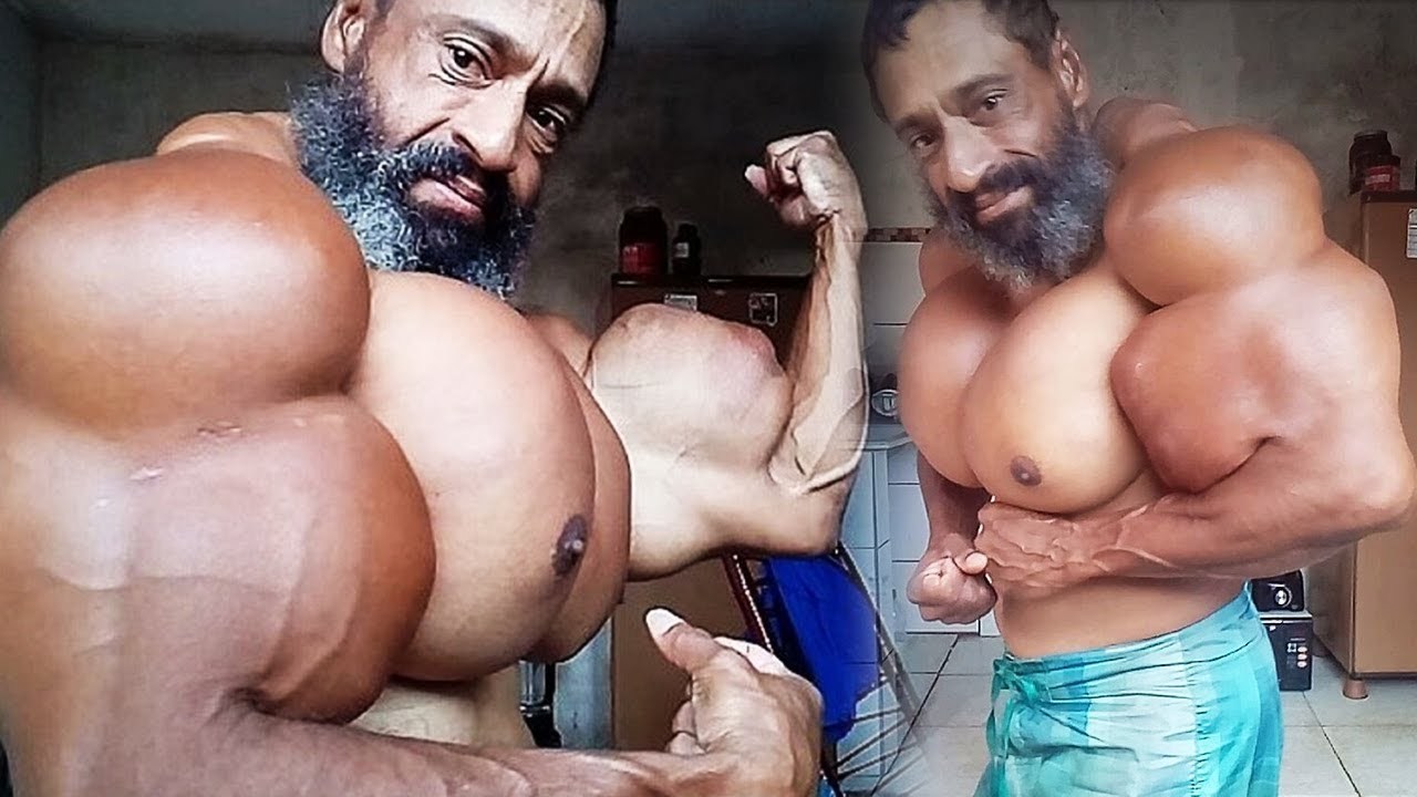 Bulbosaurus from Brazil: A former drug addict injects himself with oil. - Jock, Synthol, Longpost