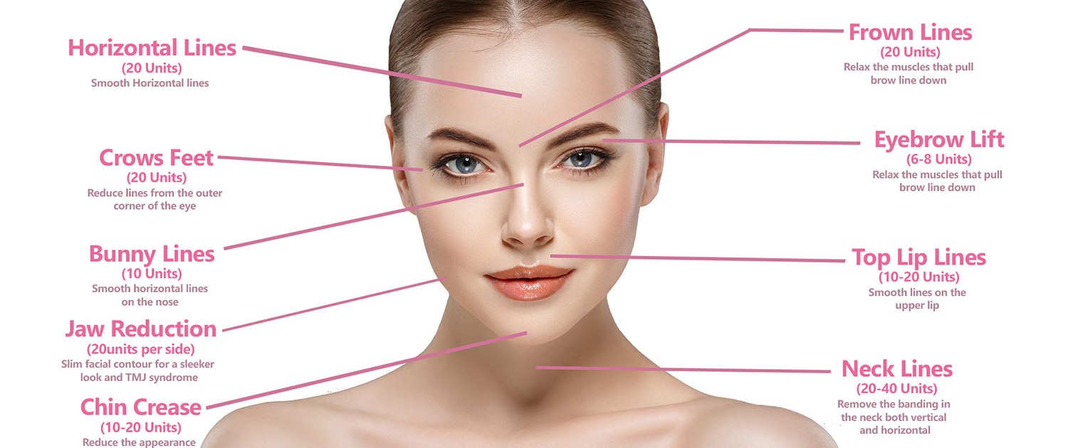 Botox, what is it and why everyone uses it - My, The male, Female, beauty, Medications, Cosmetology, Appearance, Video, Longpost, Men, Women