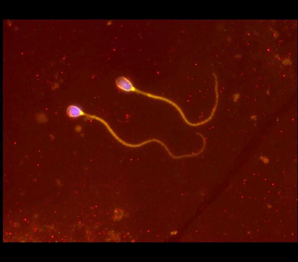Сперма Живет Во Влагалище