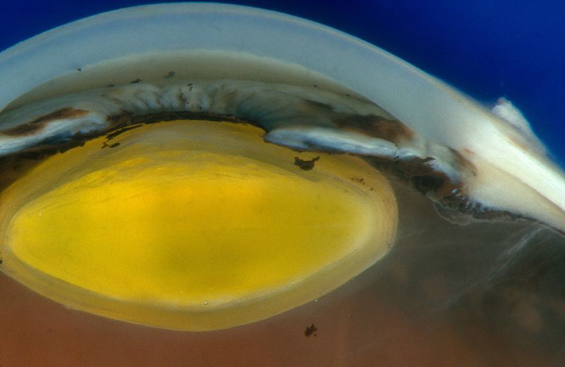 Woman gets first cornea from 'reprogrammed' stem cells (Nature, Sep 2) - The science, news, Biology, The medicine, Stem cells, Japan