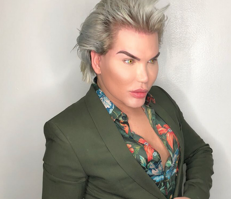 How to turn into a living Ken? Operation history of Rodrigo Alves. - My, Cosmetology, Plastic surgery, Face, The medicine, Fashion, beauty, Psychology, Longpost