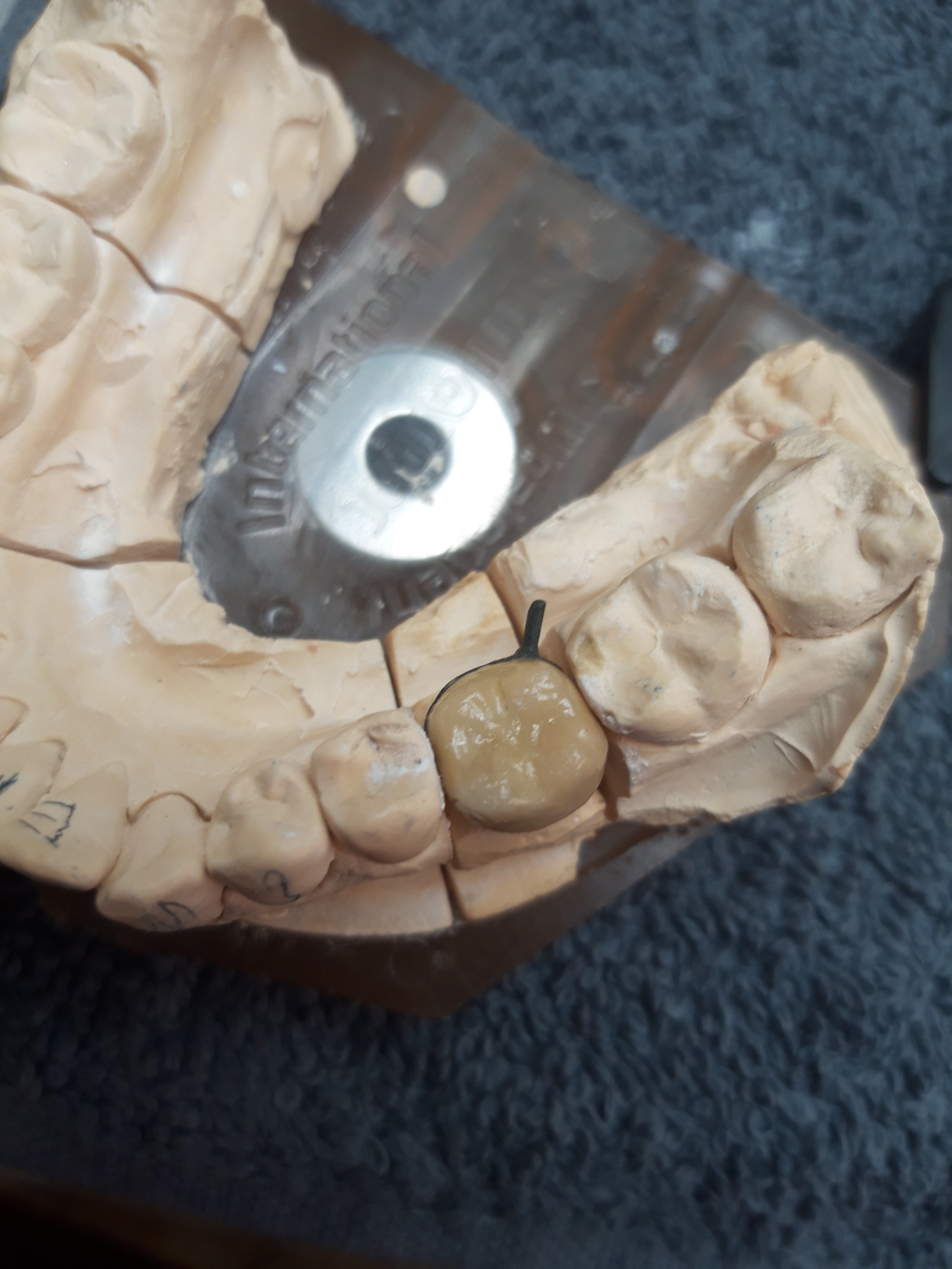 What kind of animal is this dental technician? - My, Dentistry, Orthopedics, Work, Longpost