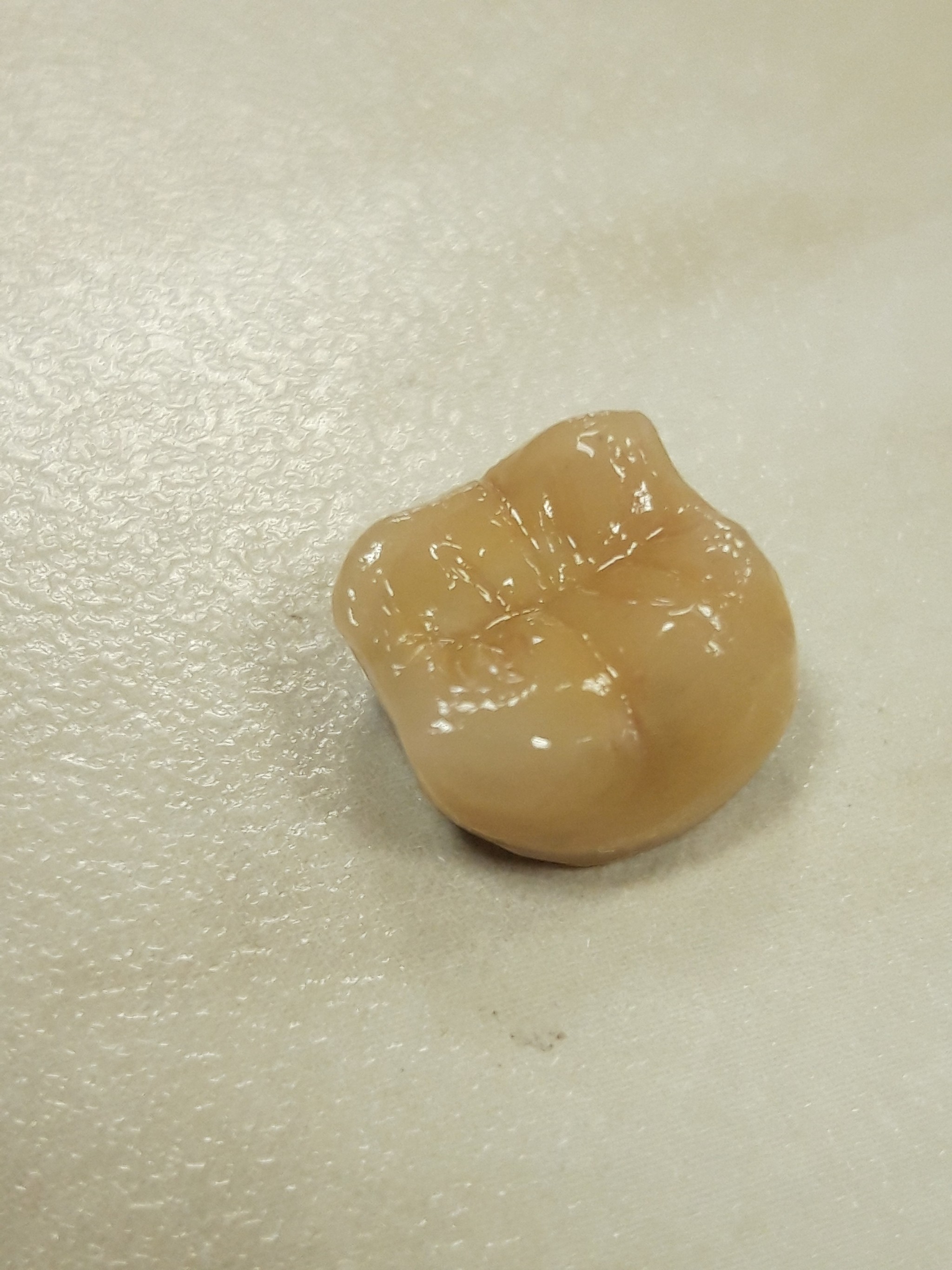 What kind of animal is this dental technician? - My, Dentistry, Orthopedics, Work, Longpost