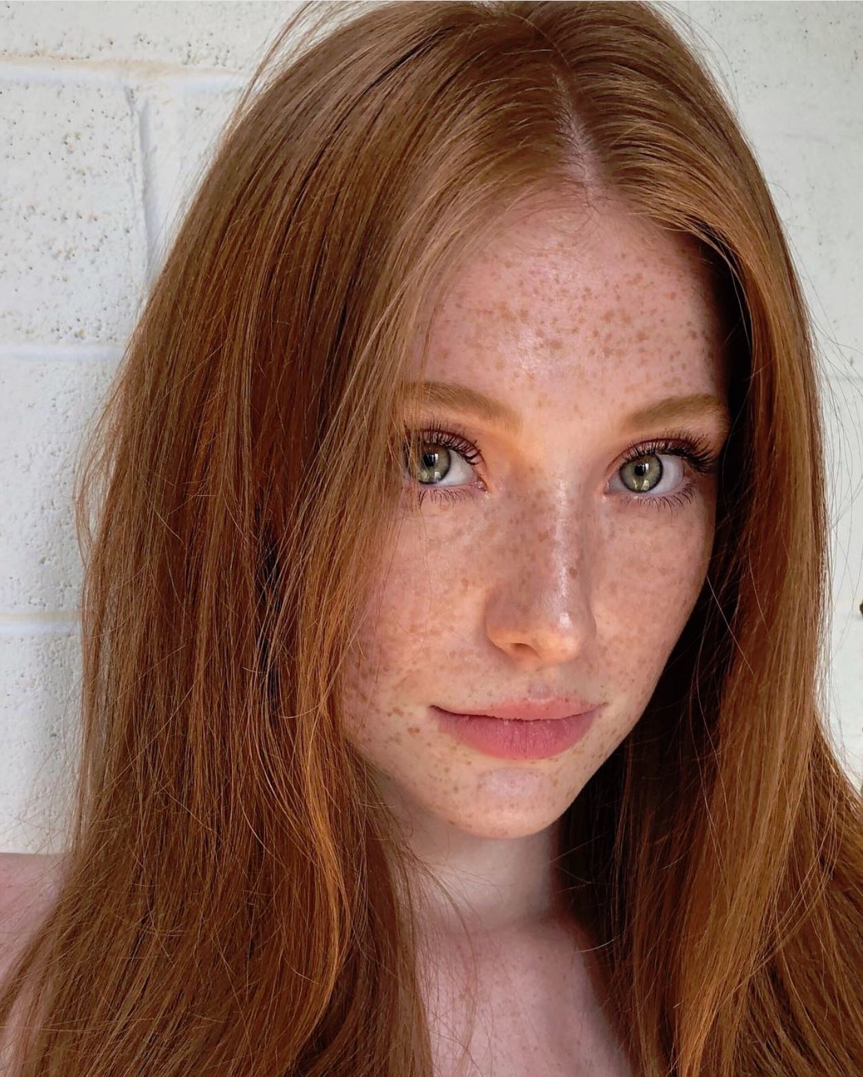 Teen Freckles