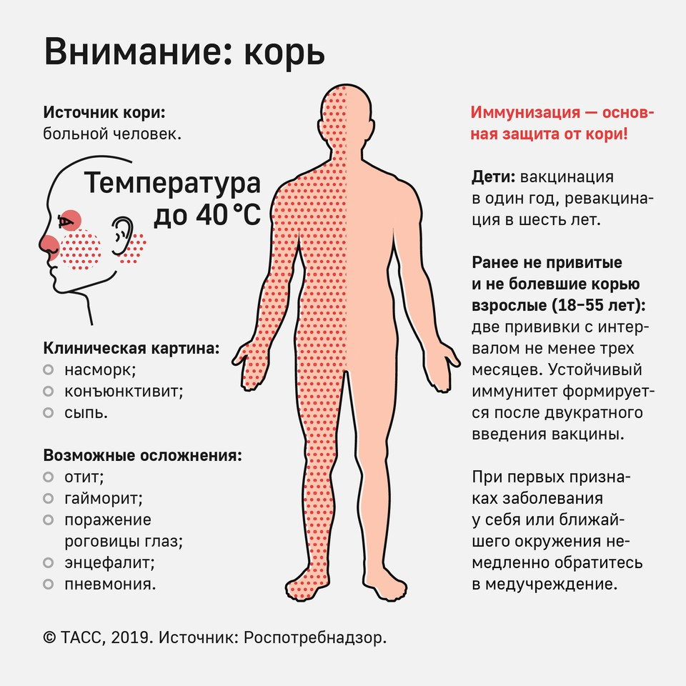 Более 50 детей умерли в Самоа от эпидемии кори | Пикабу