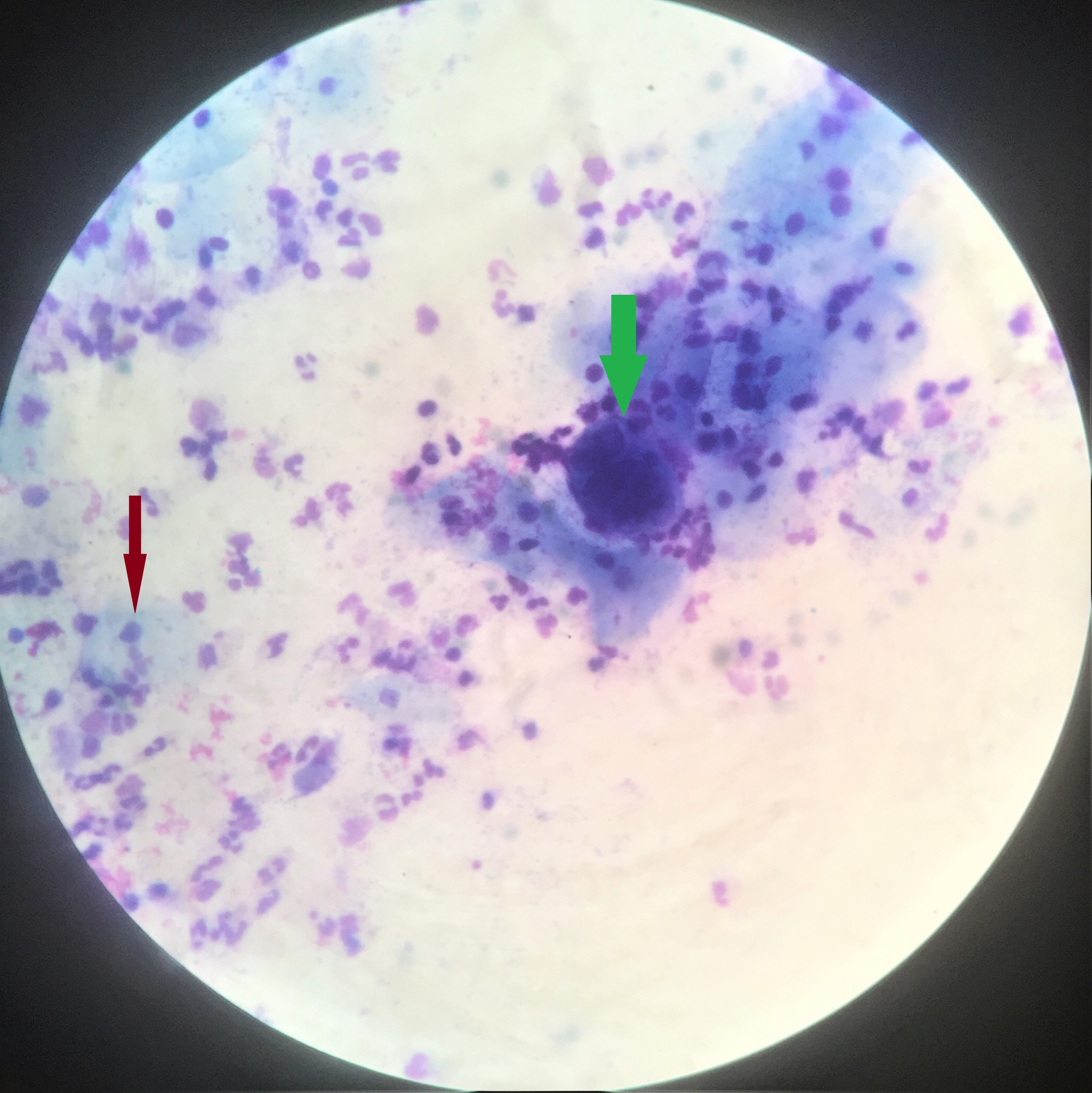 Laboratory diagnostics. Microscopy - My, Laboratory, Diagnostics, Microscope, Microscopy, Analysis, Herpes, Virus, Longpost