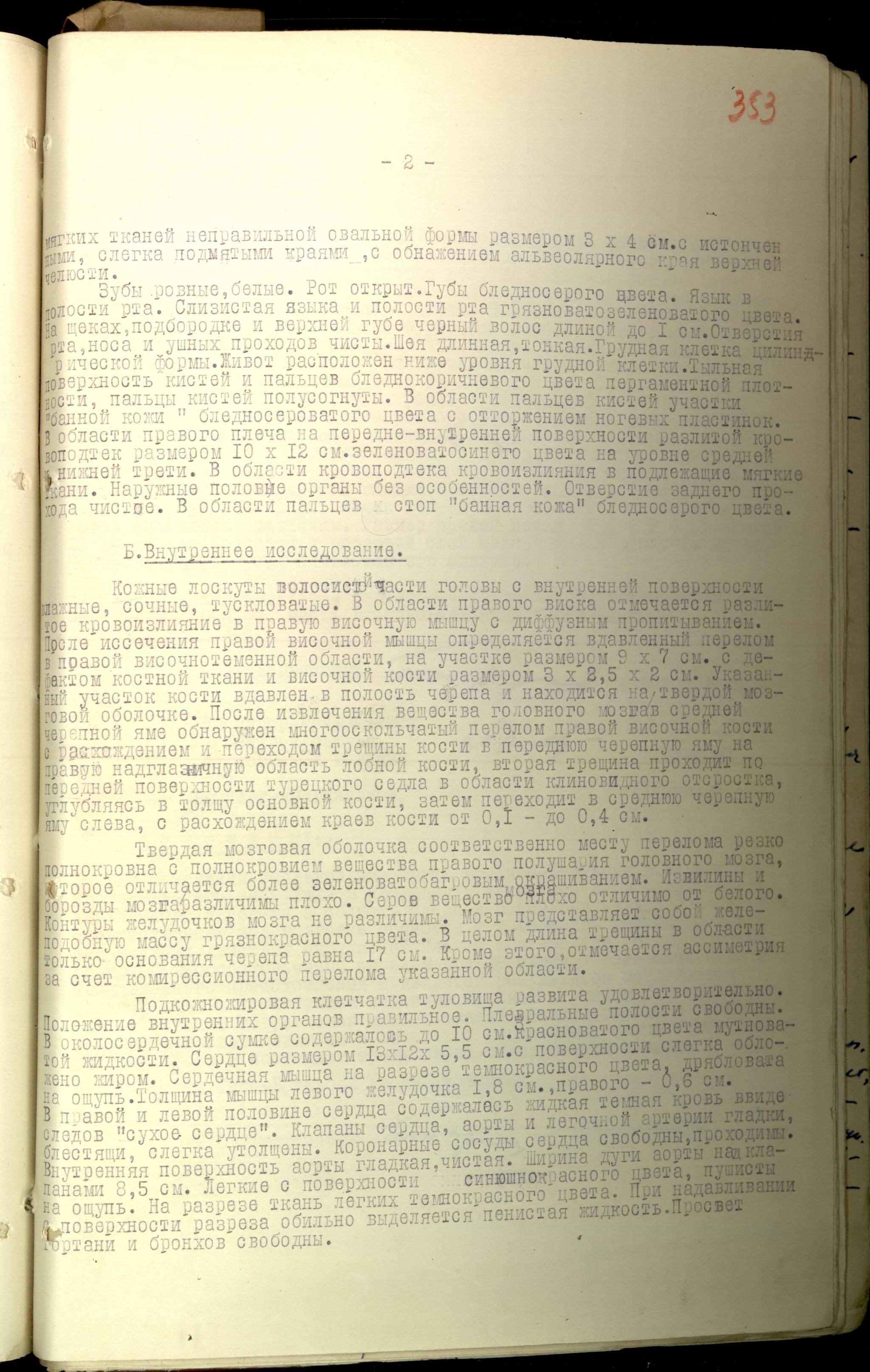 Monthly Thibault-Brignolle stubble. Another evidence of the forgery of the campaign and filming of the Dyatlov group - Dyatlov Pass, Story, Mythology, Longpost