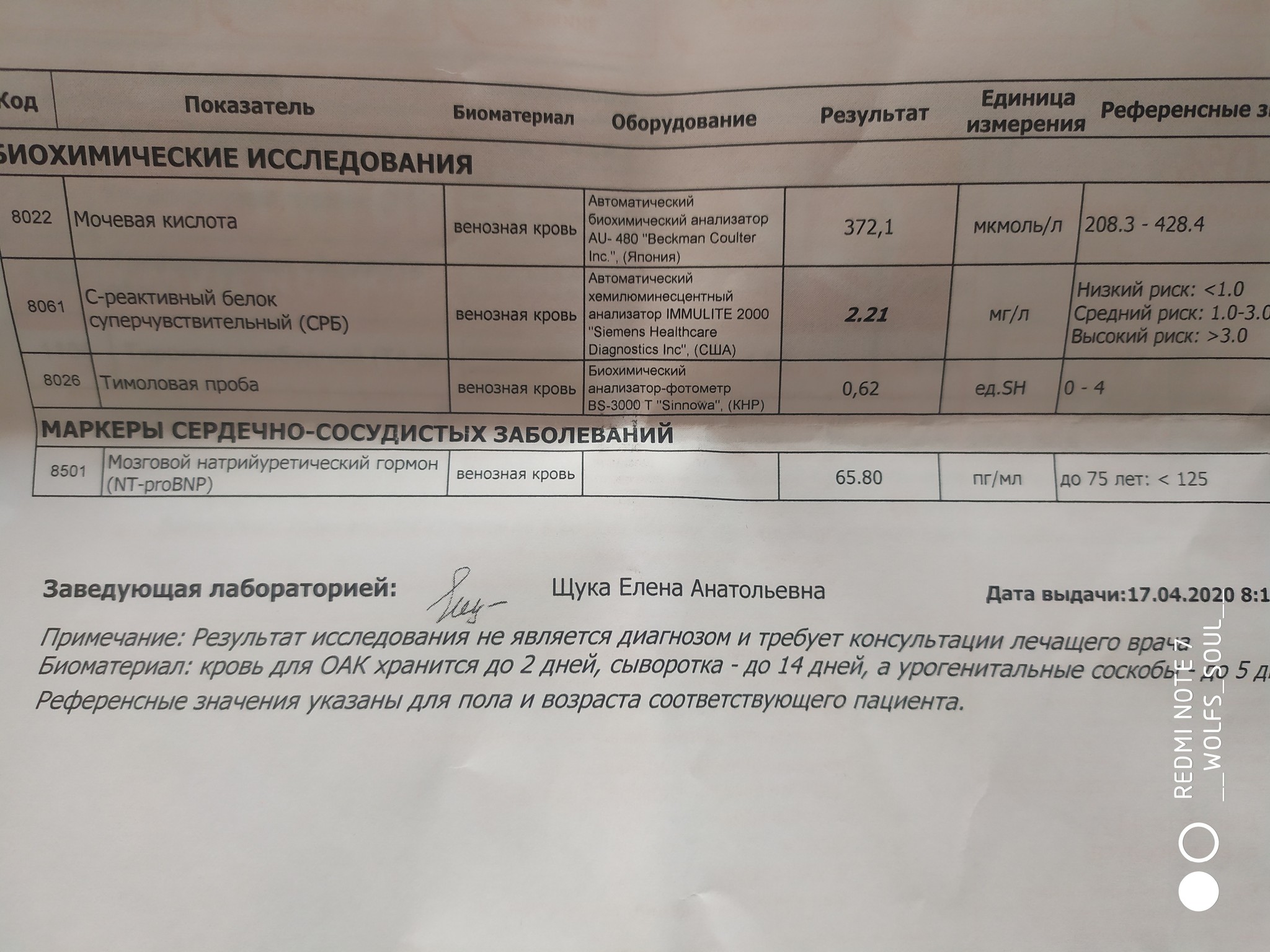 Что стало причиной ? И где искать? - Моё, Шум в ушах, Артериальное давление, Длиннопост