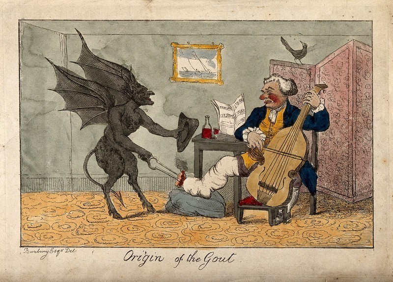 Why there was a gout epidemic in Britain in the 18th century, and how it changed the course of history - Gout, Epidemic, Story, England, Interesting, Longpost