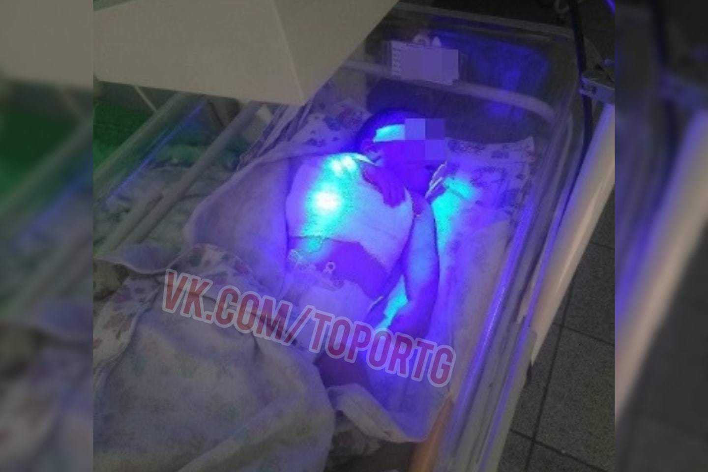 Russia and maternity hospitals - Novosibirsk, Birth of a child, Broken arm, Operation, Without anesthesia, Longpost