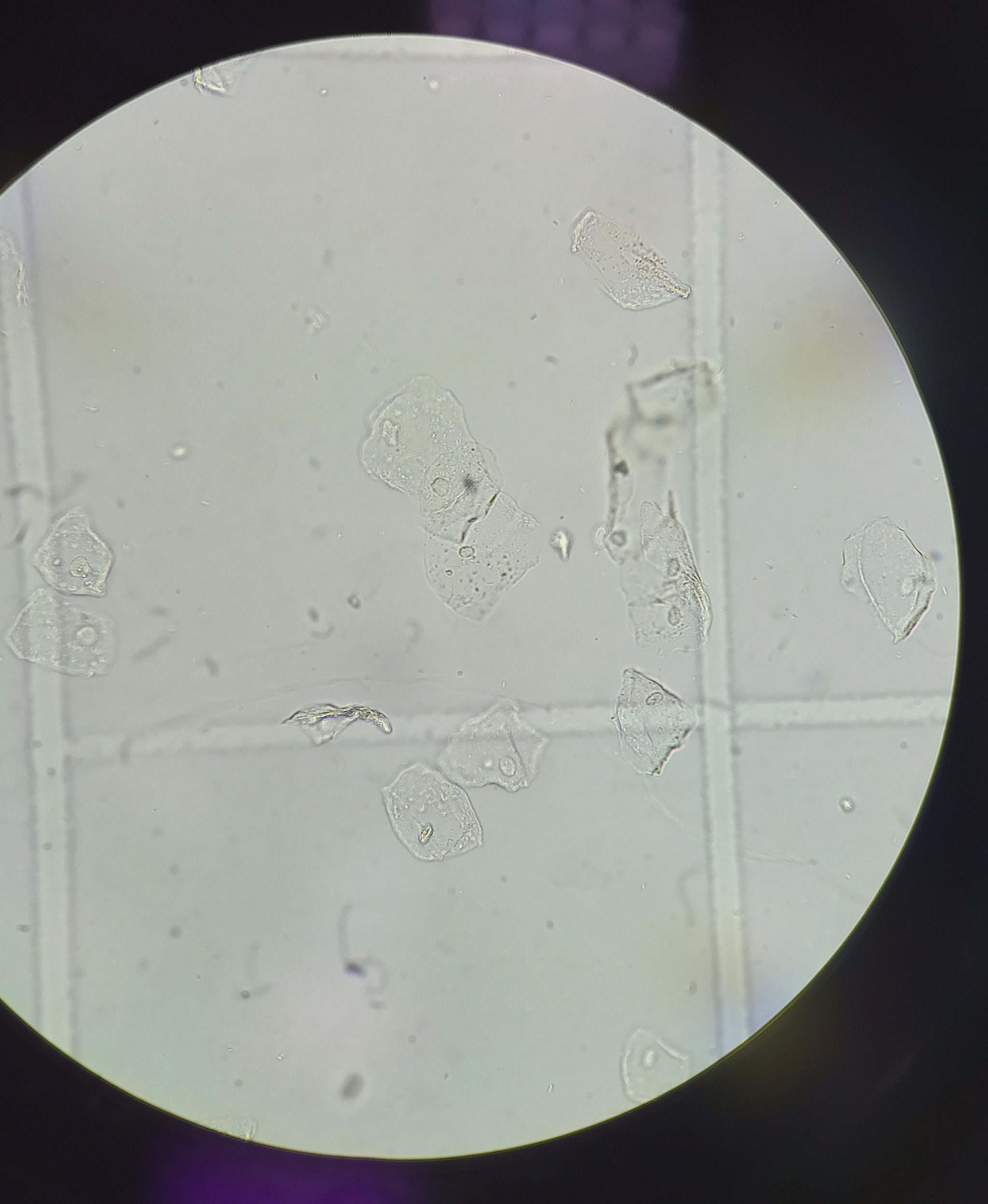 Микроскопия мочи 50-40-45 в п/Эр. Эпителий яблока в микроскопе. Женская смазка под микроскопом. Бактерии и слизь в моче у женщин