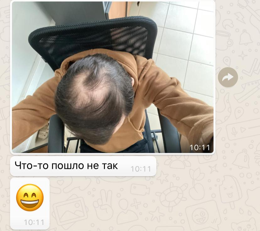 When something went wrong - My, Old age, Bald head, 30 years, Hair, Прическа, Friends