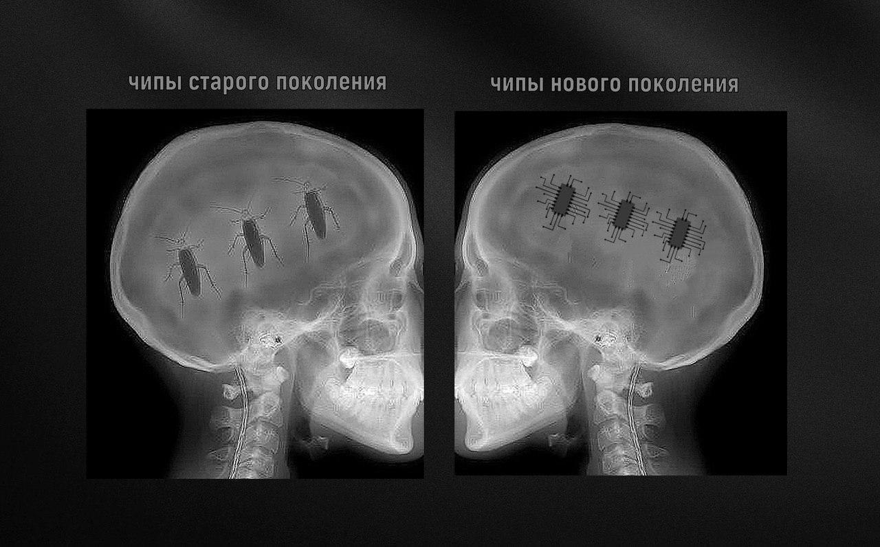 Микрочипы для людей в России