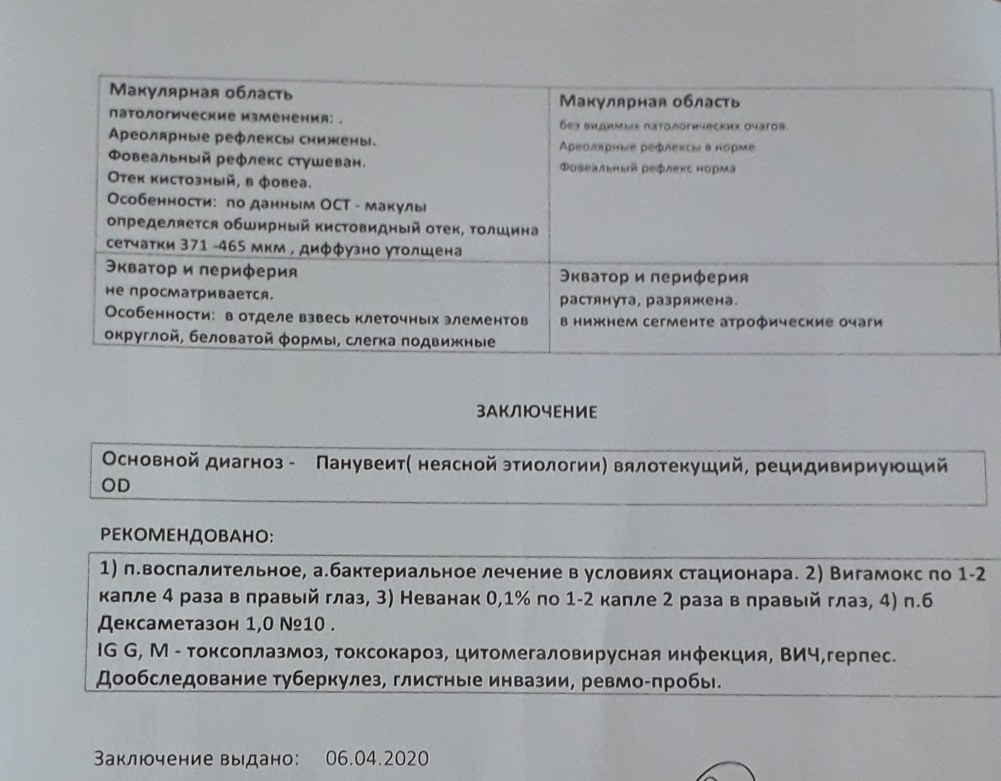 Нужен совет офтальмолога | Пикабу