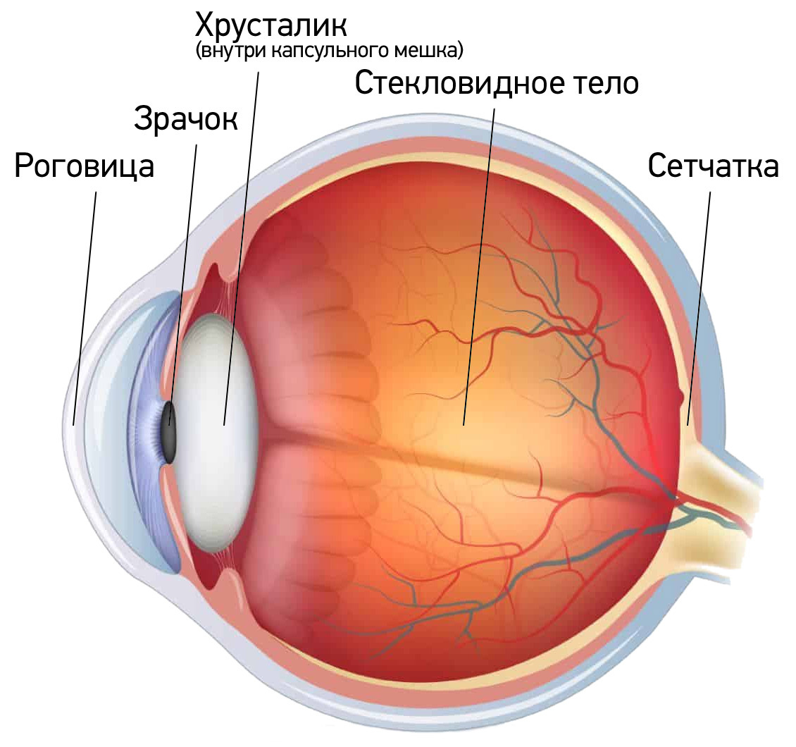 More about keratoprosthetics and keratoprostheses - My, Cornea, Prosthesis, Eyes, Surgery, Operation, Ophthalmology, Longpost