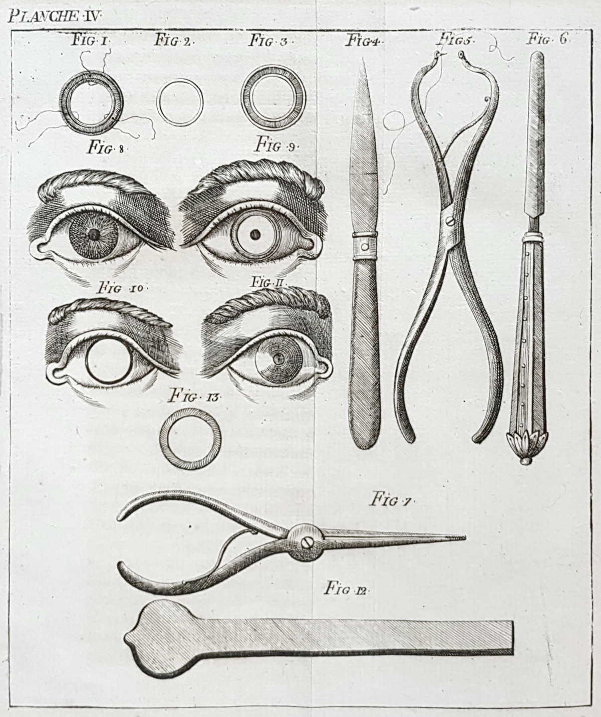 More about keratoprosthetics and keratoprostheses - My, Cornea, Prosthesis, Eyes, Surgery, Operation, Ophthalmology, Longpost