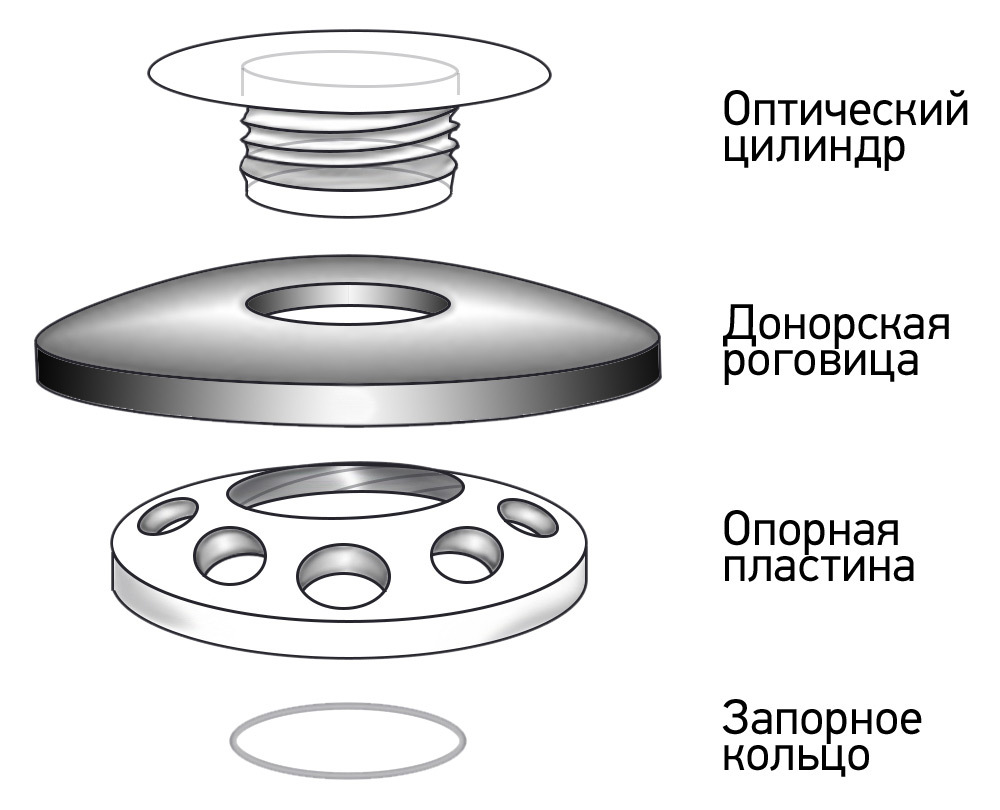 More about keratoprosthetics and keratoprostheses - My, Cornea, Prosthesis, Eyes, Surgery, Operation, Ophthalmology, Longpost