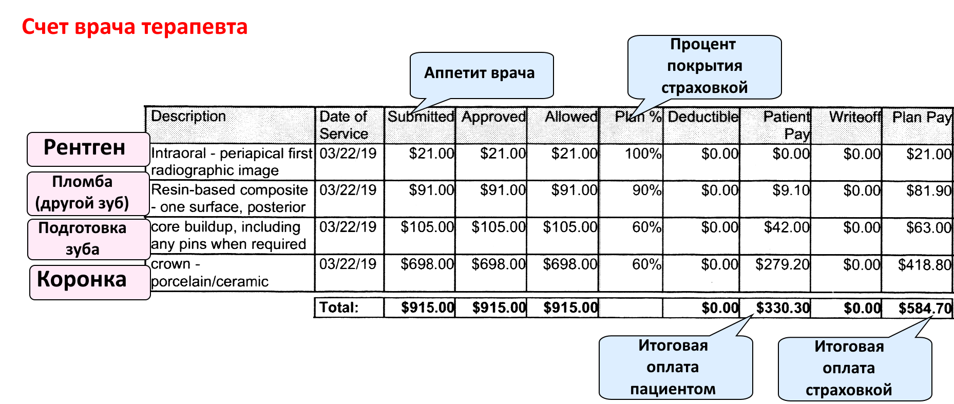 Dentistry in the USA - bill for installing a crown - My, Dentistry, Paid medicine, The medicine, USA, Living abroad, Health insurance, Longpost