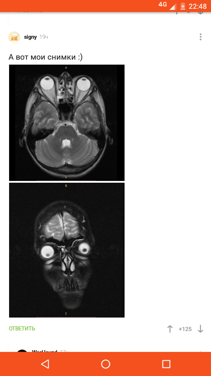 Love me for inner peace - MRI, Comments, Fearfully, Longpost