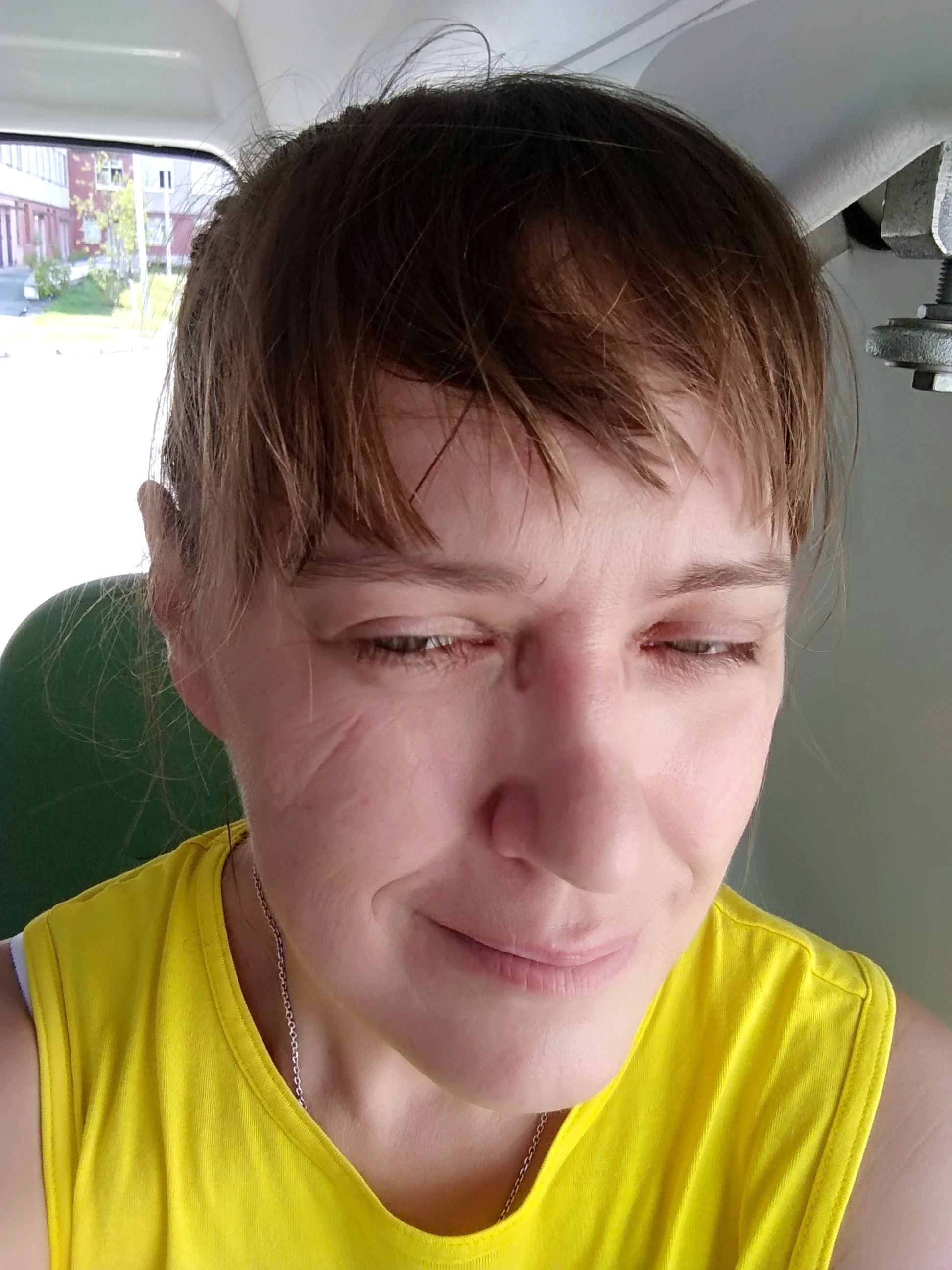 Skorov's stories #167: The story of my face - My, Real life story, Coronavirus, Ambulance, Skorovskie stories, Face, Longpost