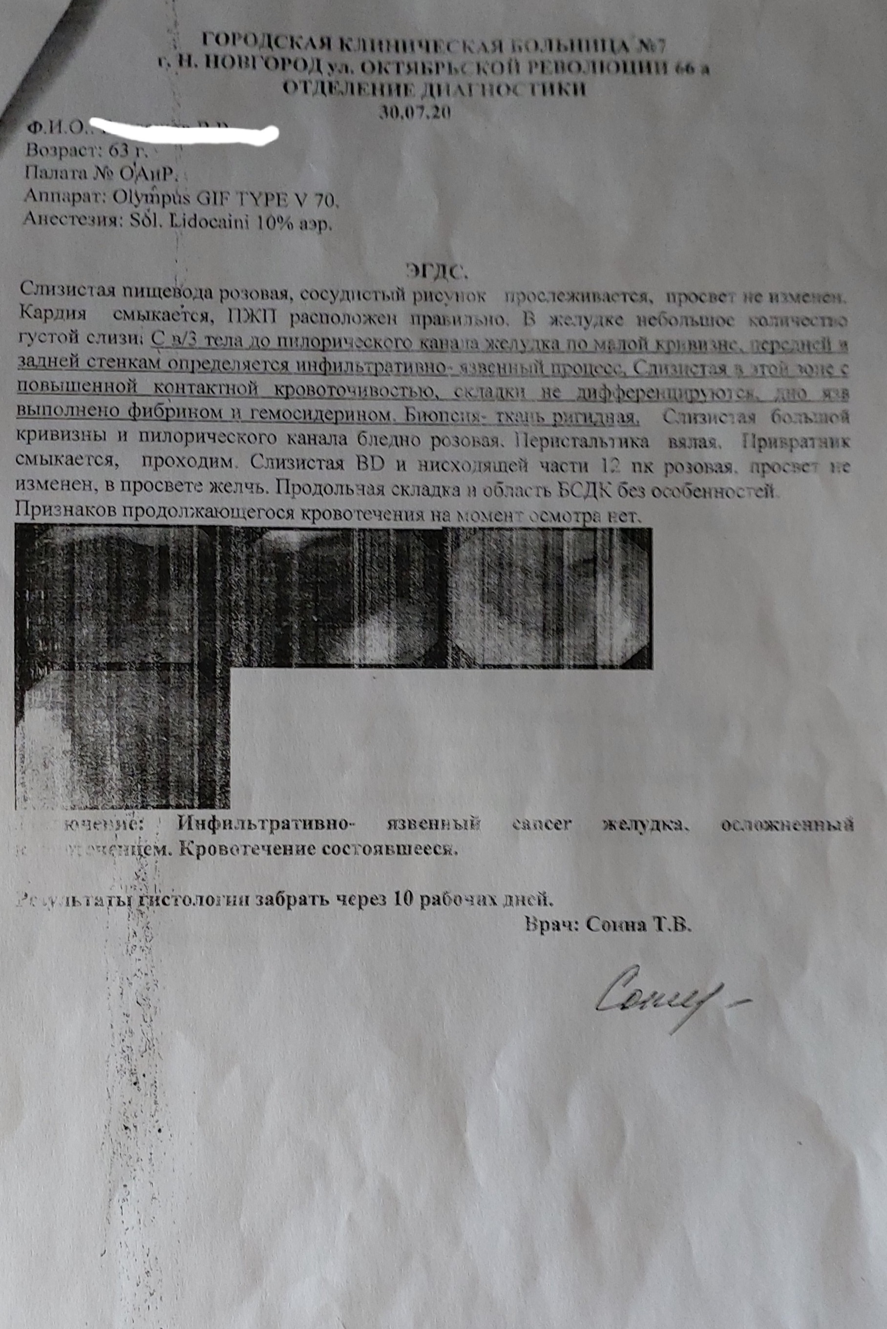 Прошу совета онко-врачей - Моё, Онкология, Рак и онкология, Помощь, Длиннопост