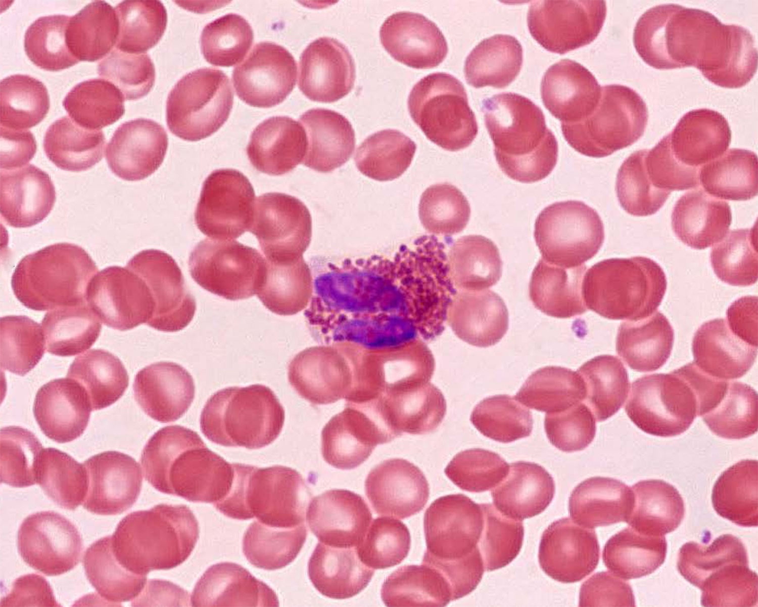 Blood under a microscope. Part 1. Red blood cells, neutrophils, basophils and eosinophils - My, The medicine, Histology, Microscope, Informative, Longpost