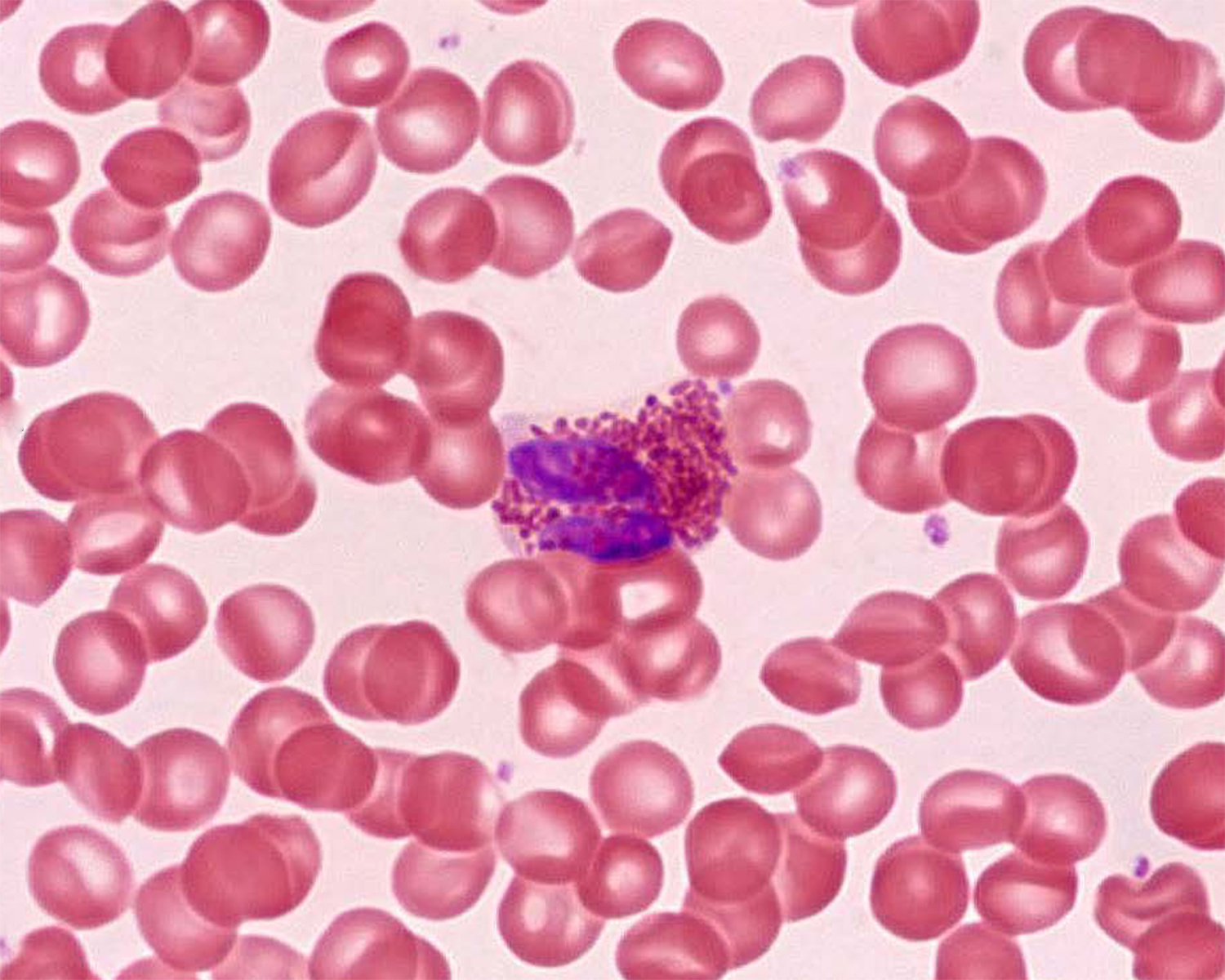 Blood under a microscope. Part 1. Red blood cells, neutrophils