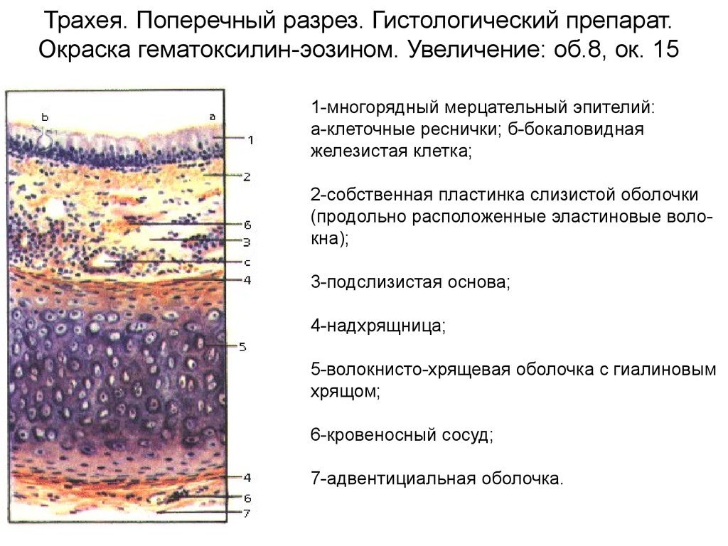 Чем бы болеем. Грипп №1 | Пикабу