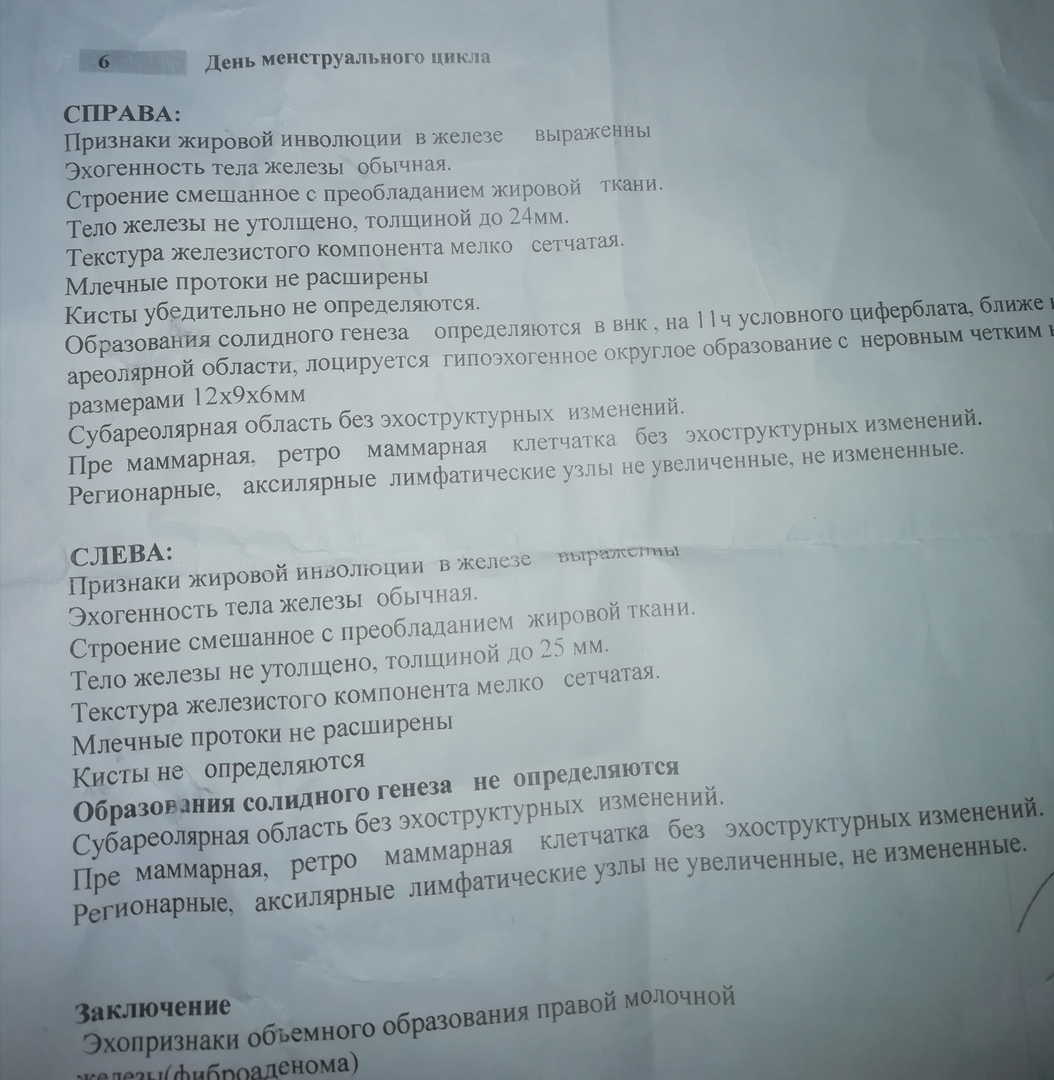 Нужен совет - фиброаденома, киста и прочие неизведанные ранее прелести |  Пикабу